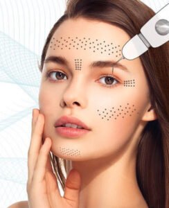 Nâng Cơ Trẻ Hóa Da Plasma Fibroblast 06/2023 2 Plasma Fibrolast xóa sẹo rổ Vi Beauty Academy