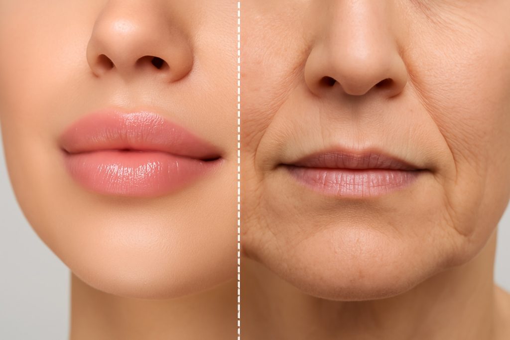 so sánh plasma fibroblast và co2 laser môi - Hieu qua plasma